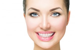 invisible braces grayslake invisible braces grayslake